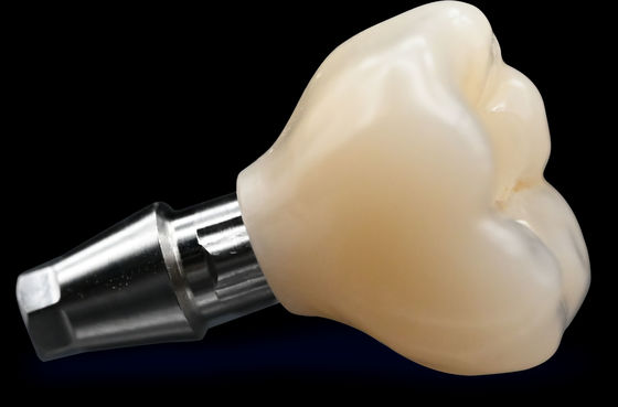 kaufen CAD / CAM Implantat Krone Brücke Hohe Ästhetik Zirkonie Krone online manufacture