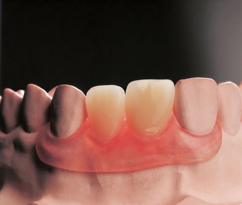 kaufen Flexible Flipper Entfernbare Zahnprothesen Klinische Entfernbare Teilprothesen online manufacture