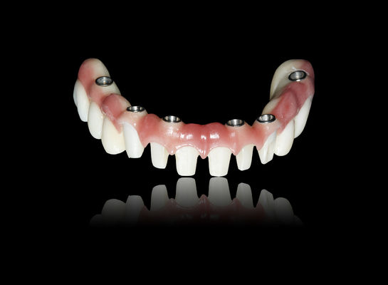 kaufen Alle auf X Implantat Zirkoniebrücke Implantat Kronenbrücke Naturbild online manufacture