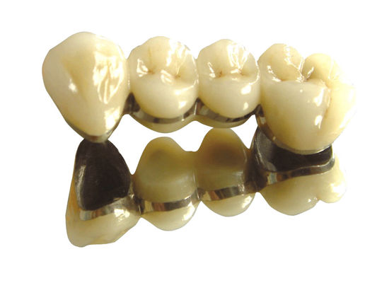 kaufen Weiße Edelmetallkrone und Brücke Edelmetallkrone und Brücke online manufacture