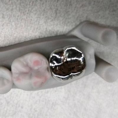 kaufen Vollmetallkrone und Brücke Hochgenauigkeit Silber temporäre Krone online manufacture
