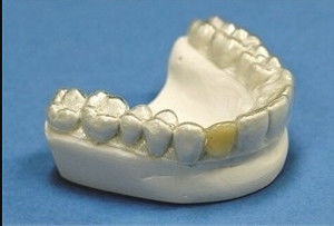 kaufen Zahnpflege Stabile Zähne Orthodontische Halterung Professionelle klare Halterung online manufacture