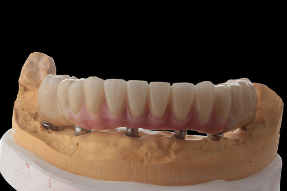 kaufen Hybride Zahnimplantate Hybride Zahnprothese mit Titanstahl online manufacture
