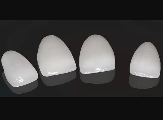 kaufen Hohe Ästhetik Kompositkrone Onlay Veneer Anpassungsgröße online manufacture