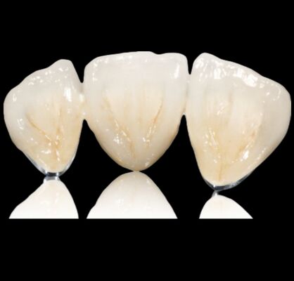 kaufen Anpassbare Halb-Edelstahlkrone oder -Brücke online manufacture