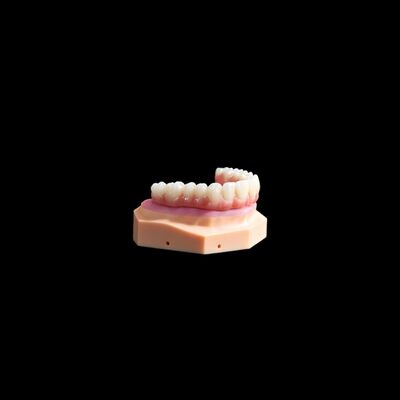 kaufen Alle auf X-Implantat Titanium Brücke Zahnmedizin mit Composite genau online manufacture