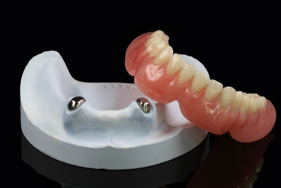 Teleskopentherapie mit Abnehmbaren Zahnprothesen Präzisionsanschluss Overdenture Arylic