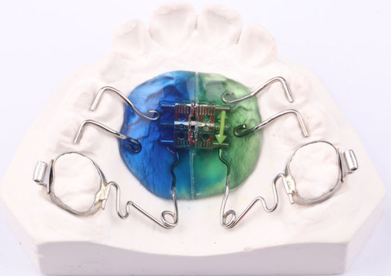 FDA Pendelgerät Orthodontie Pendel Ortho Gerät anpassbar
