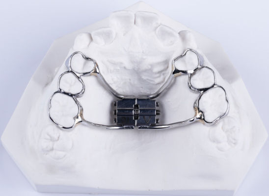 Festgefertigter zweiseitiger Zahnpalate-Expander Zahnpalate-Spreader