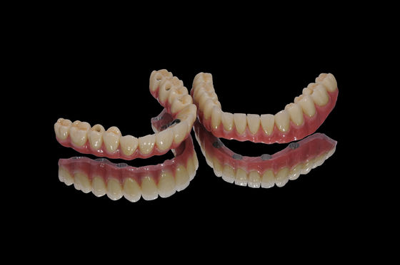 Alle auf X Implantat Zirkonie-Brücke mit Titanbasis Zirkonie-Kronenbrücke