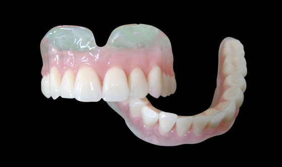 Vertex-Klarheit Teilweise Überprothese Ausnehmbare Teilweise Prothese
