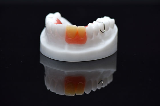 Akrylflipper entfernbare Überprothese kundenspezifische entfernbare Acrylprothese