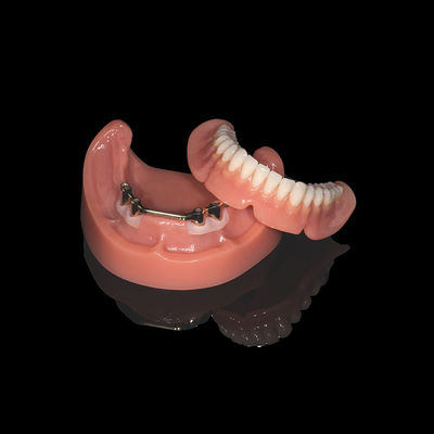 Pink Titanium Stange Entfernbare Zahnprothesen mit Acryl Zahnprothese Finish