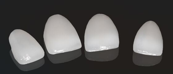 Hohe Ästhetik Kompositkrone Onlay Veneer Anpassungsgröße